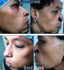 body modification horns