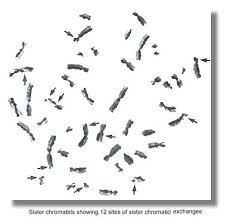 sce, bioeffects of ultrasound