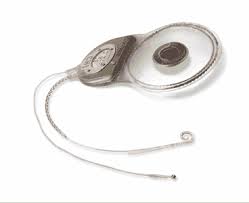 Cochlear Implants - The Bobby