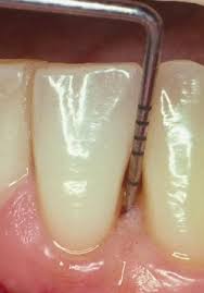 periodoncia Periodoncia