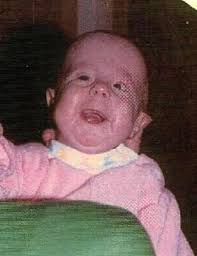 Life: Trisomy 18 - Rose