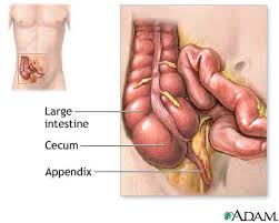 Appendectomy - series