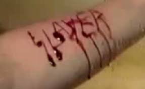 cutting yourself