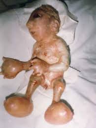 Depleted Uranium: Dead Babies