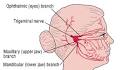 Trigeminal <b>Neuralgia</b> (Tic