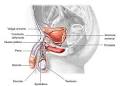 cancer de <b>prostata</b>