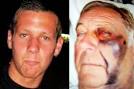 The attacker, Reece Kent, 19, landed punches on the face of Grandfather Ken ... - Cancer-patient