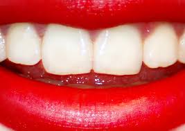 Красивые зубы Images?q=tbn:ANd9GcQ7O3bvciFzLuqDpPY23GK3CRGKNgMsmE0fb-hH1YvIz7v_43fT