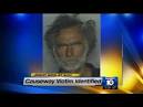Face-chewing victim face surgery, long recovery - Worldnews.