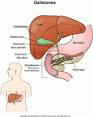 <b>pancreatite</b>