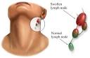 Lymph Node Locations - Neck, Groin, Ear, Diagram, Pictures ...