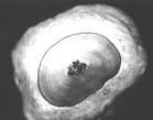 <b>Secondary dentine</b> looks marble