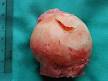 <b>Femur head</b> showing a flap of