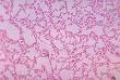 <b>Bacteroides</b>