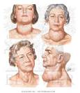 <b>Endocrine System Diseases</b>