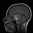 pituitary-gland.jpg