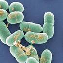 Common Foodborne Pathogens: Listeria monocytogenes | Publications.