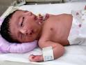 Paediatric Ward Senior Registrar Dr Qaisar Aziz said that the new born baby ... - Two-faced-baby