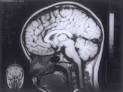 Images in Clinical Practice