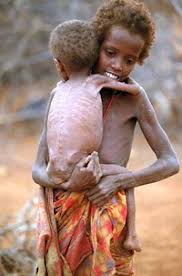 الصومال تدخل مجاعتها الكبرى منذ 20 عامًا.. كيف يمكنك أن تتبرع وتساعد؟ Images?q=tbn:ANd9GcQn8QBOQj8B6tMCN2ZL-zGJe9SS00GMHbV4CemDFO0bWJG7g-rw
