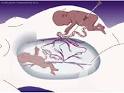 <b>TRANSFUSION FETO</b>-<b>FETAL</b> Y