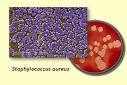 aureus <b>Bacteremia</b>