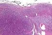 and the <b>adrenal cortex</b> it