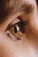 <b>deficiência</b> de <b>vitamina A</b>