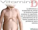 Déficit de <b>vitamina</b> D: