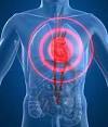 <b>Chest Pain</b>