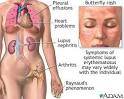 cases of <b>lupus</b> every year