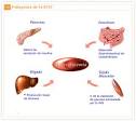 <b>Diabetes Mellitus Tipo 2</b>