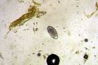 File:<b>Haemonchus</b> contortus.jpg