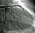 An <b>angiography</b> is a type of