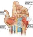 A inflamação de um <b>tendão</b> é um