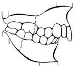 <b>Angle Class</b> II molar