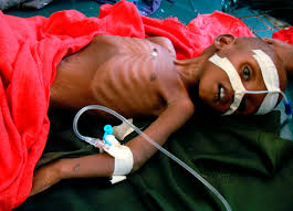صور أطفال الصومال .. وهم يستغيثون Images?q=tbn:ANd9GcRf2Zft74vpYIIGWV0o4c417XcRQ7Uu-ZRnyi3DGXQZGfCRKs3S