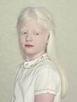 Beautiful portraits of albinos by Gustavo Lacerda - Lost At E.
