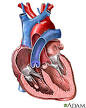 <b>Heart Valve Diseases</b>: