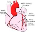 La <b>isquemia miocárdica</b> y la
