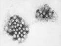 Microbe Gallery: NOROVIRUS | Disease Detectives