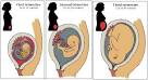 Health Care During <b>Pregnancy</b>: