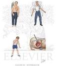 <b>Ataxia</b>: Gait and Limb