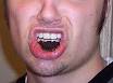 Dipping tobacco - Wikipedia, the free encyclopedia
