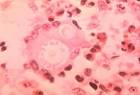 Dimorphic Fungi
