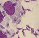<b>Toxoplasma</b>-Gondii2