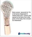 Osteosaroma bone cancer is the