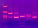 File:Gel <b>electrophoresis</b> 2.jpg