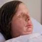 Charla Nash Reveals Face Transplant After Brutal Chimp Attack ...