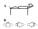 <b><b><b>Nistagmo Patológico</b></b></b> www.lookfordiagnosis.com